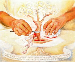 zeitgenössische kunst von Diego Rivera - Die Hände von Dr. Moore 1940
